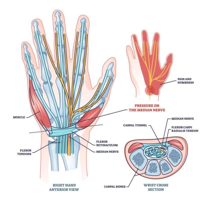 Skeletni detajli zapestja na rentgenu, fokus na karpalnem kanalu in medianem živcu