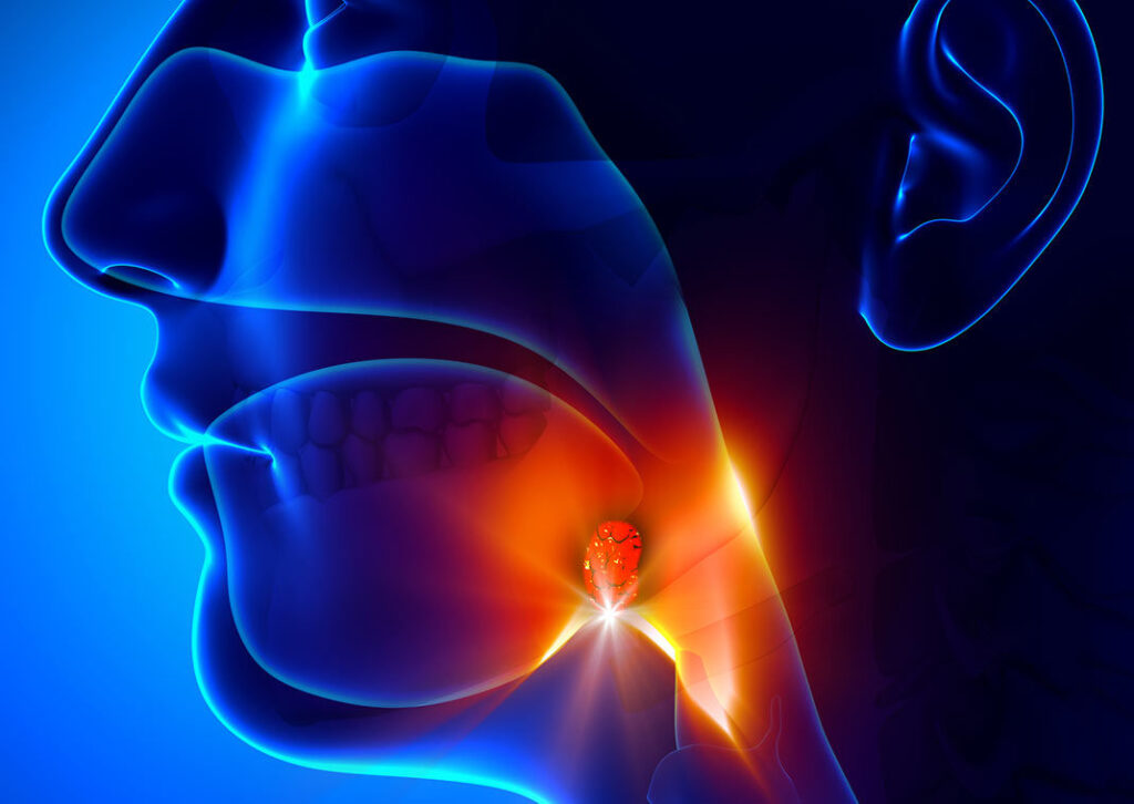 hripavost- vnetje mandljev