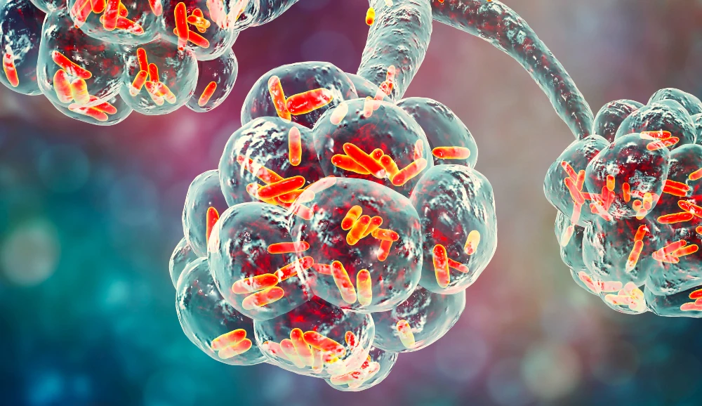 bonhitis - virusna okužba